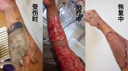 小虎鱼身上有白膜正常吗怎么治：小虎鱼身上出现白膜正常吗怎么治小虎鱼身上有白膜正常吗 虎鱼百科 第2张