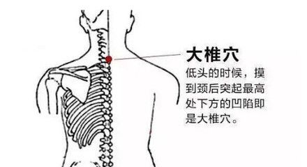 龙鱼头朝下尾巴朝上怎么治：龙鱼头朝下尾巴朝上怎么办 龙鱼百科 第2张