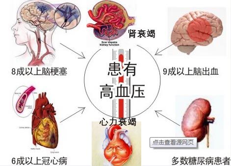 高血压可以吃龙鱼吗：高血压患者可以吃龙鱼吗？ 龙鱼百科