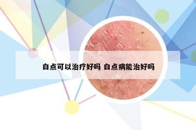 观赏鱼治疗白点病需要停食吗（治疗观赏鱼白点病需要停止喂食吗？） yee 第4张