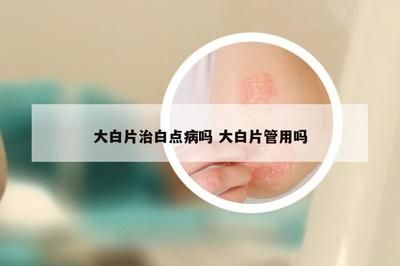 用大白片给龙鱼缸鱼做检疫可以吗有毒吗（使用大白片给龙鱼缸鱼做检疫是可行的，且做检疫是可行的） 龙鱼百科 第2张