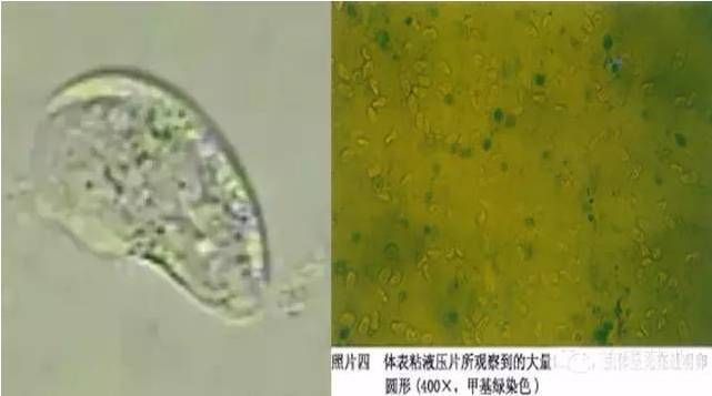 红龙鱼内寄有什么症状（如何预防红龙鱼内寄生虫）