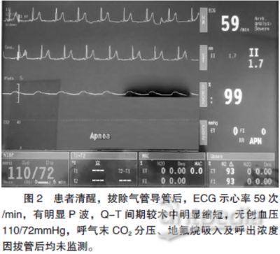 MS-222麻醉效果对比研究，ms-222与其他麻醉剂对比研究