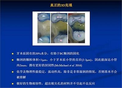 生物陶瓷滤材的维护方法，生物陶瓷滤材的维护 观赏鱼市场（混养鱼） 第4张