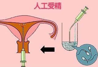 大白鲨人工授精技术，大白鲨人工授精技术难点, 观赏鱼市场（混养鱼） 第3张