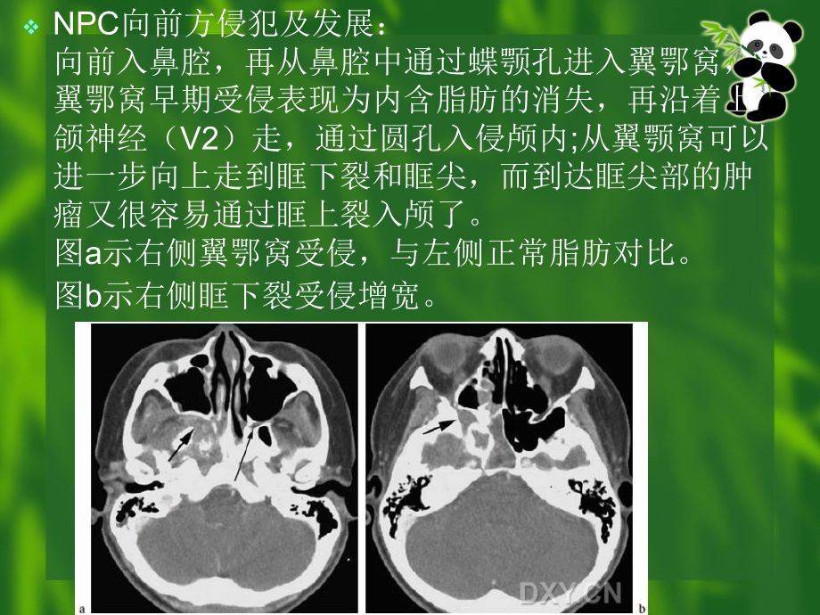 龙鱼烂鼻孔：如何判断龙鱼烂鼻孔的严重程度 龙鱼百科 第3张