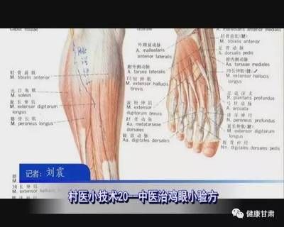 现代疼痛治疗技术对比：现代疼痛治疗技术 其他宠物 第2张