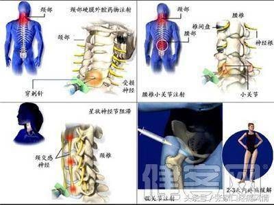 现代疼痛治疗技术对比：现代疼痛治疗技术 其他宠物 第6张