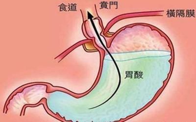 十二指肠液分析常见异常：十二指肠液分析 其他宠物 第1张