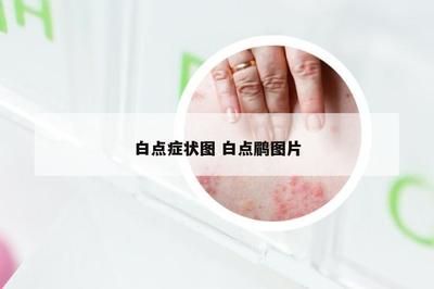 如何防治元宝鲫鱼白点病：元宝鲫鱼白点病的重要措施是预防鲫鱼白点病的关键 其他宠物 第4张