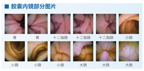 十二指肠液检查前准备：十二指肠液检查 其他宠物 第4张