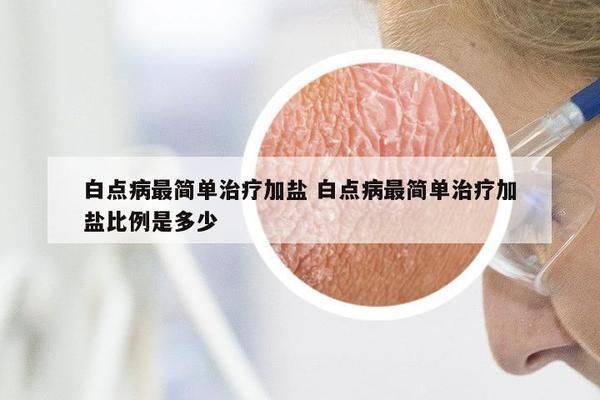 三间鼠鱼白点病的自然疗法：三间鼠鱼白点病的治疗方式 其他宠物 第2张