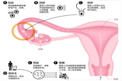 人工授精操作步骤详解：人工授精后需要注意哪些事项 其他宠物 第6张