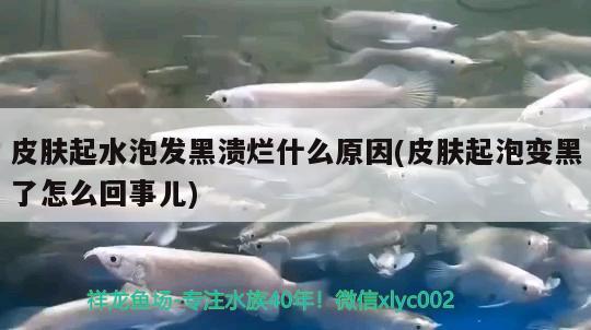 皮肤起水泡发黑溃烂什么原因(皮肤起泡变黑了怎么回事儿)